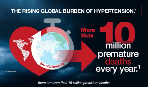 Ideal Synergy: The Power of Perindopril and Amlodipine in Hypertension Management